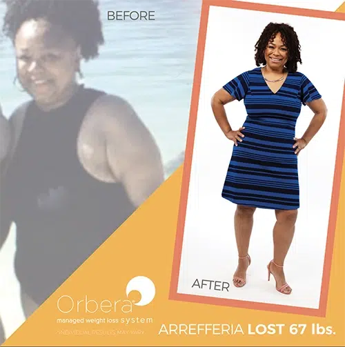 orbera gastric balloon