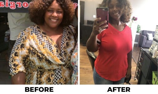 esg Tampa Weight Loss Procedures